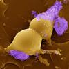 La bactérie pathogène Ehrlichia ruminantium (violet) qui adhère à une cellule endothéliale bovine (jaune) en cours de division (image de microscopie électronique à balayage en fausses couleurs, grossissement x 40 000) © D. F. Meyer, Cirad