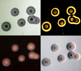 Mycoplasmes, photographie de François Thiaucourt.© Applied and Environmental Microbiology, January 2015